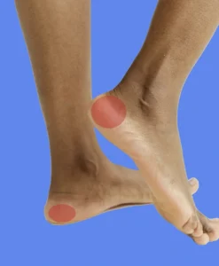 douleur persistante talon au réveil