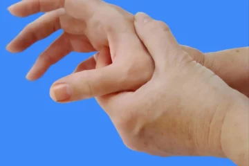 douleur après opération prothèse du pouce