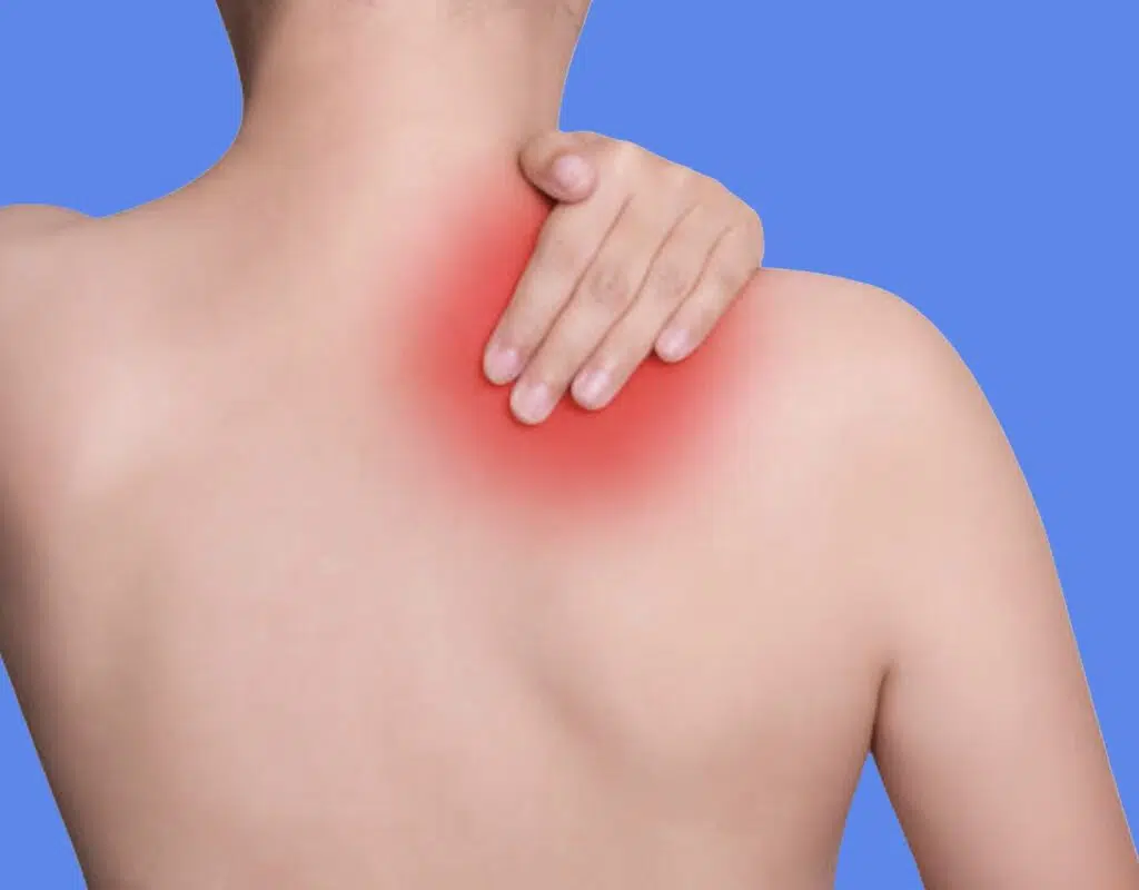 fissure tendon épaule