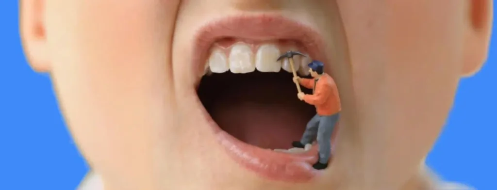 trou dans les dents : carie ?