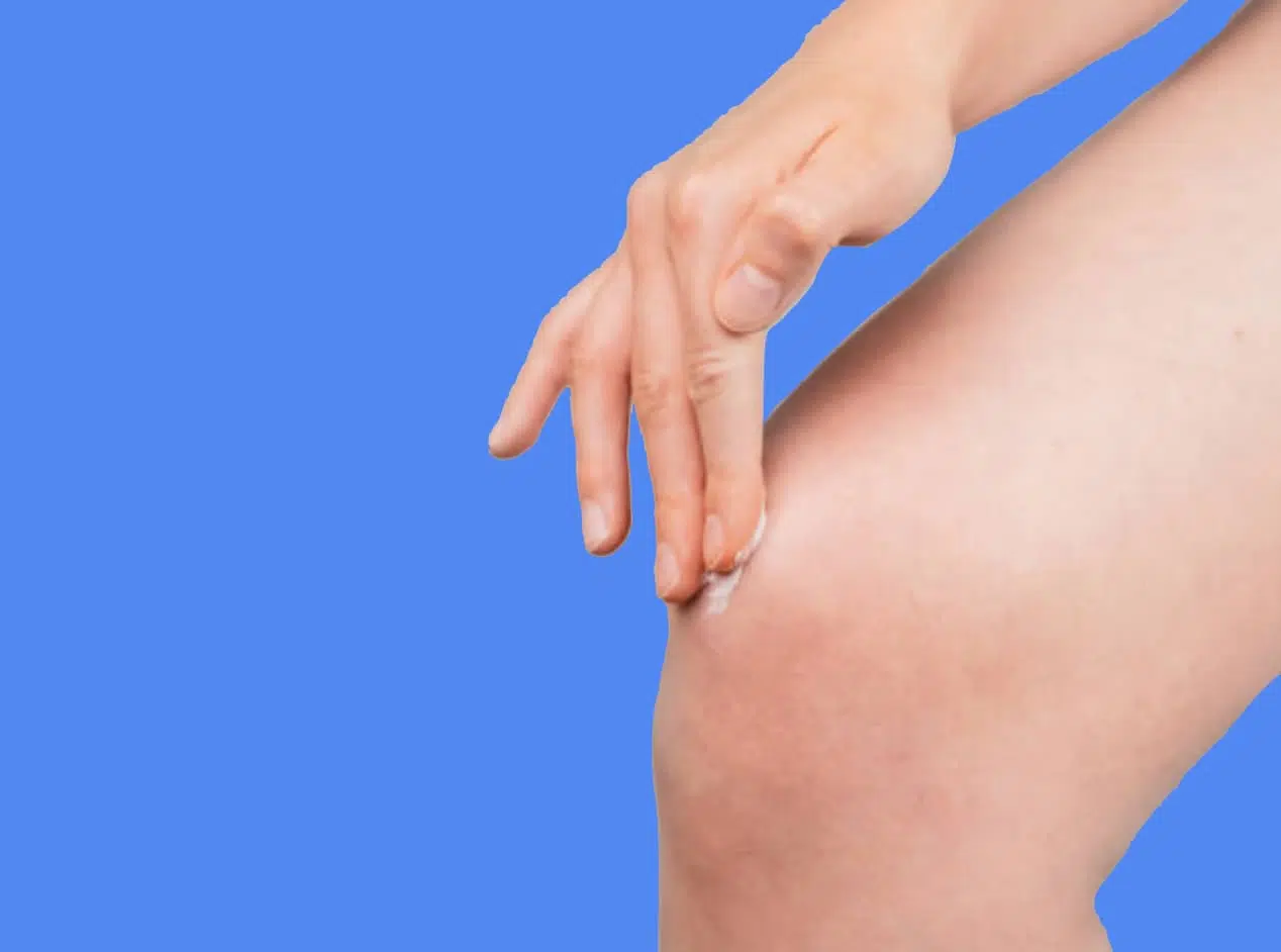 contusion genou