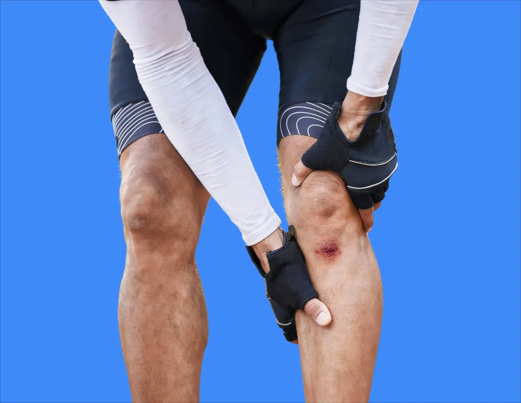 Contusion du genou apres choc