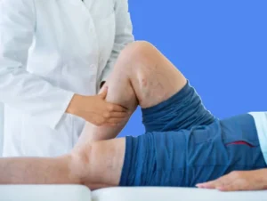 Opération varices avant après