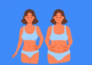 Liposuccion douce : les resultats avant/apres