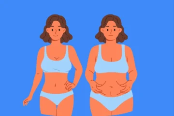 Liposuccion douce : les resultats avant/apres