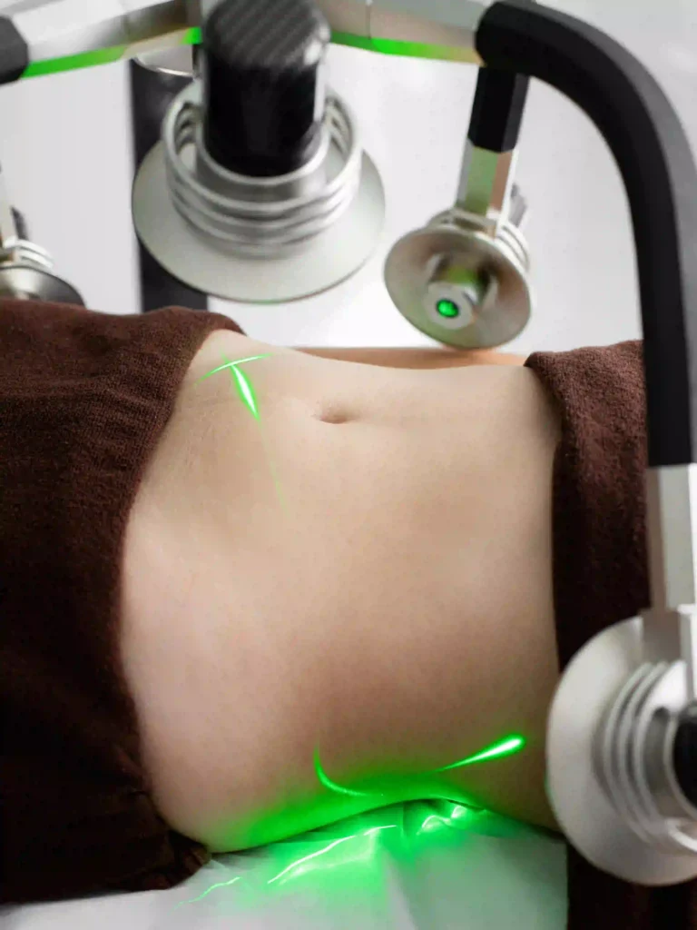liposuccion abdominale