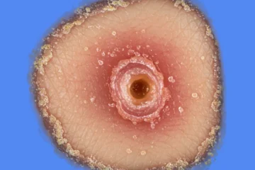 staphylocoque doré contagieux