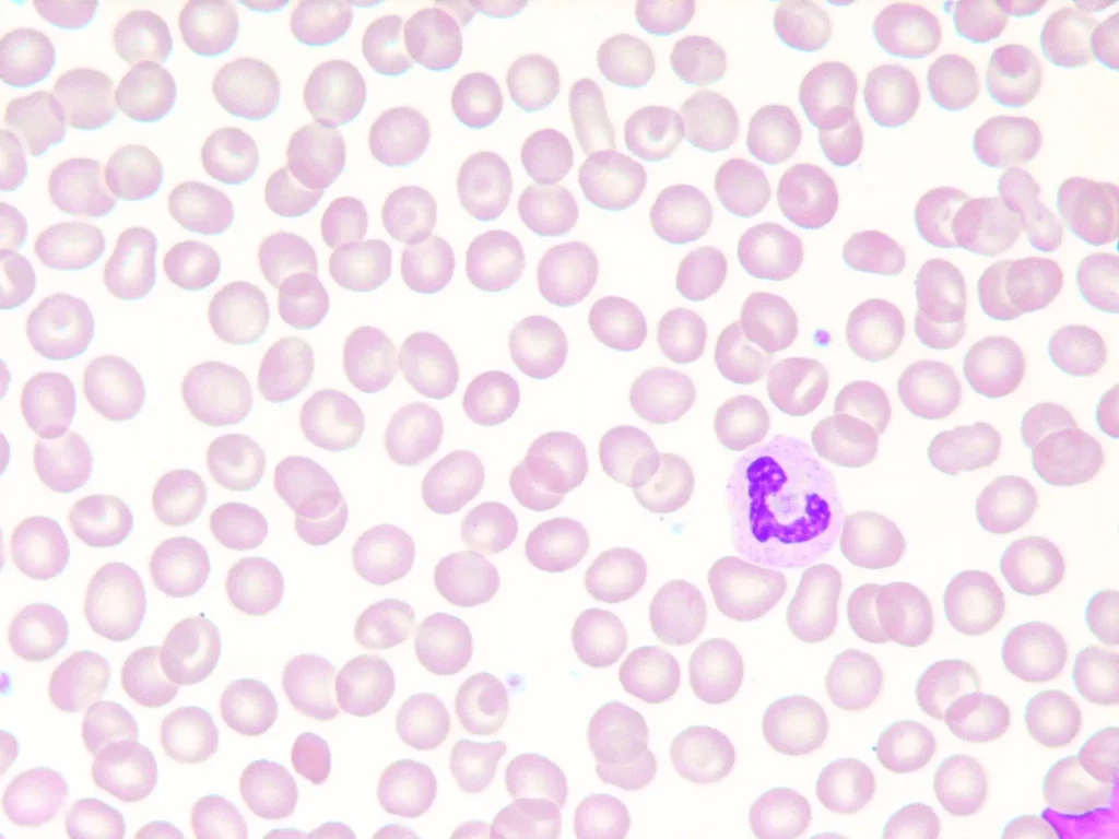 Monocyte trop bas