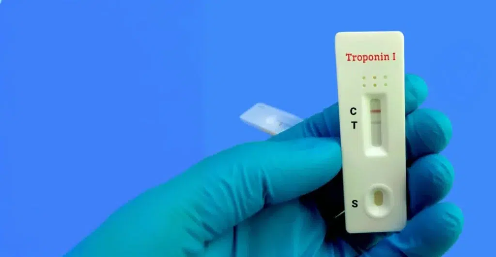 Interprétez vos résultats de troponine : normes, âge, causes et limites