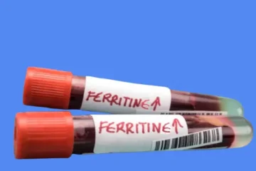 ferritine élevée et stress