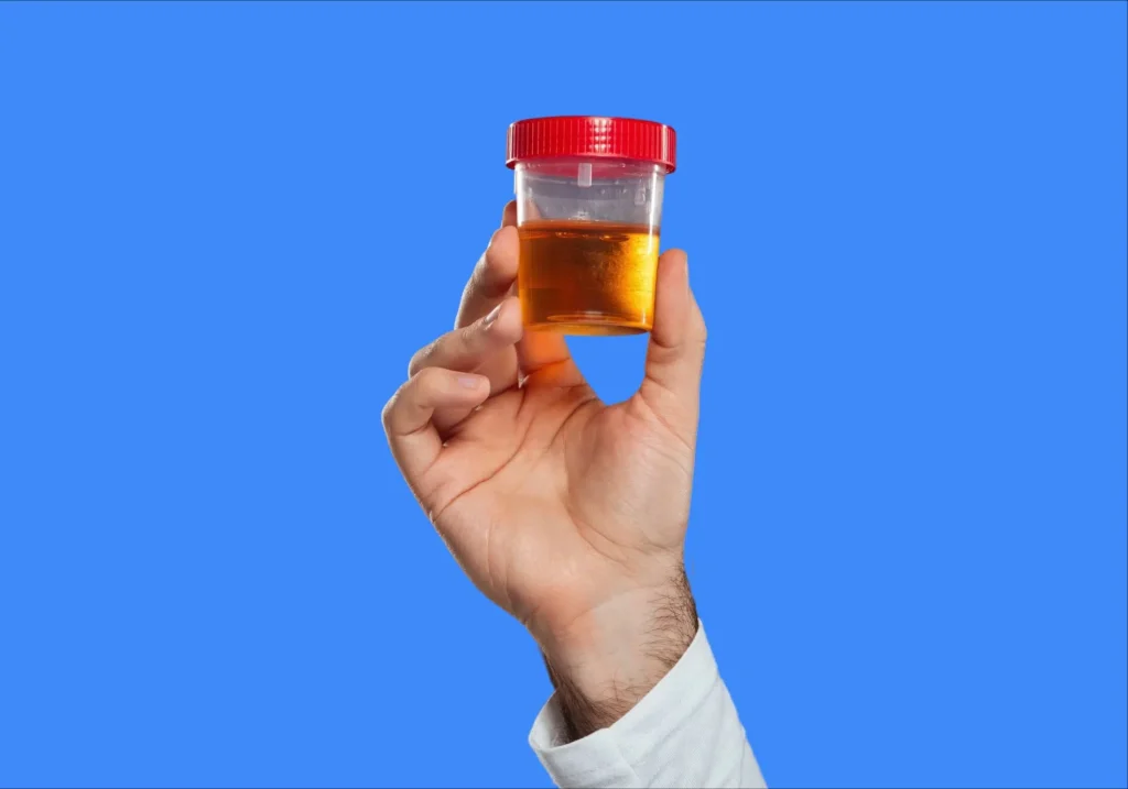 Protéinurie : Causes, Symptômes et Traitements