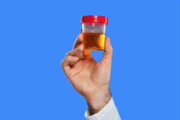 Protéinurie élevée