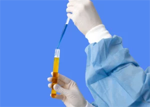 cytologie urinaire