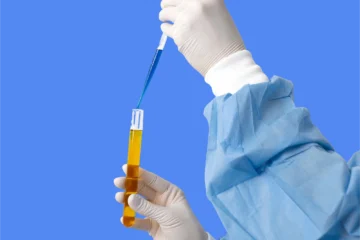 cytologie urinaire