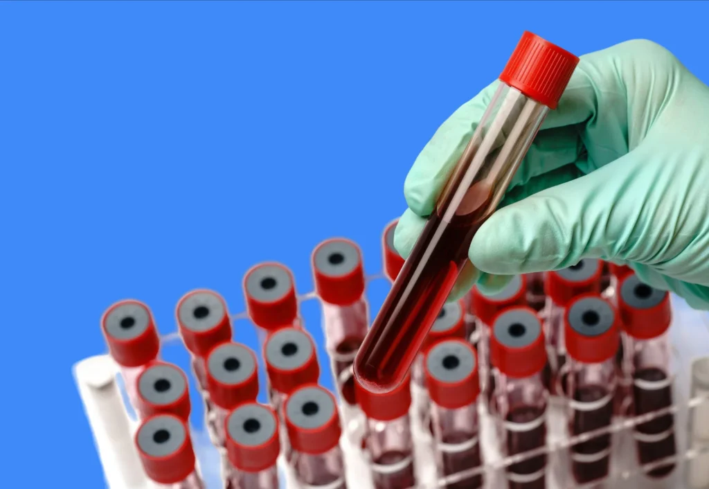 proteine c reactive trop haut