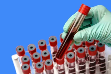 proteine c reactive trop haut